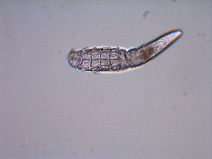 demodex mite