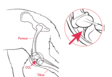 The cranial cruciate ligament, or CCL, connects the thigh bone (femur) to the shin bone (tibia). If the ligament tears, however, (see inset), the two bones slide past each other during walking and running. That's what causes the pain.